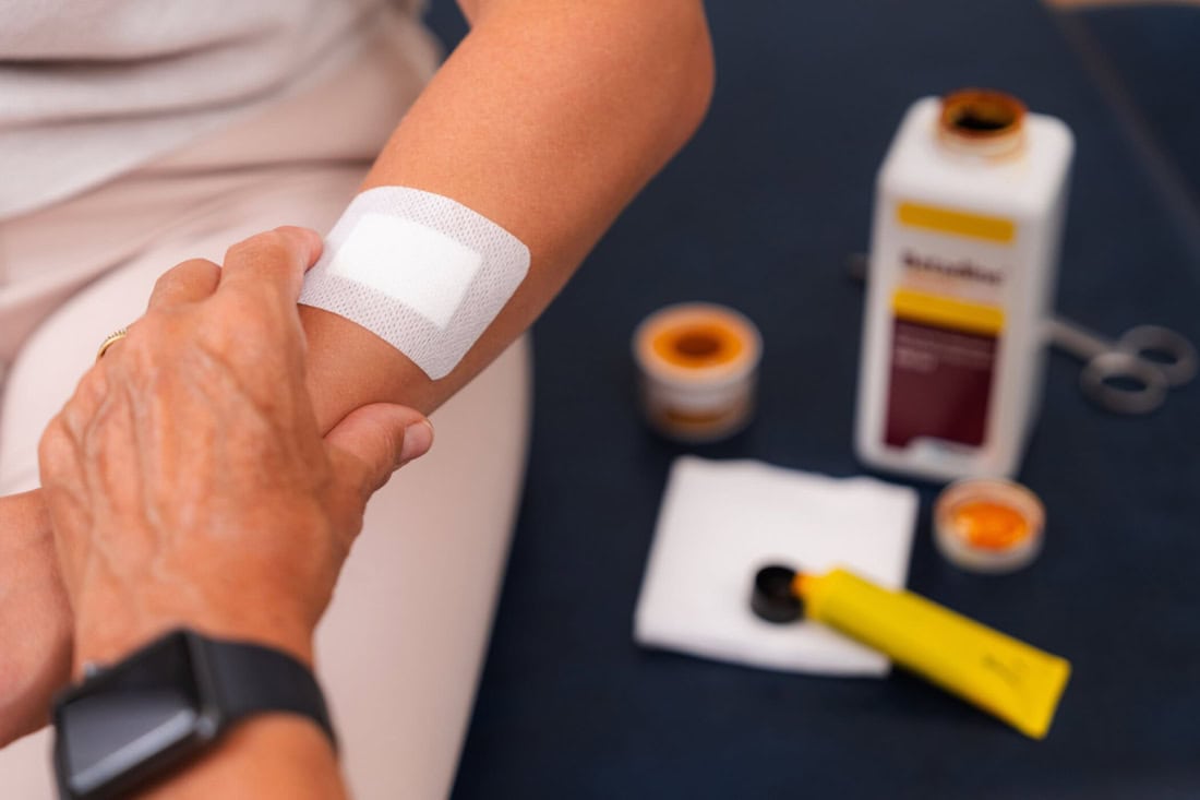 Wound care after GP surgery, dressing change and medical supplies.